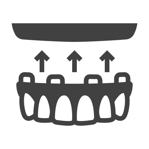 all on x dental implants in fort myers fl