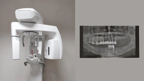 cone beam computed tomography cbct near you