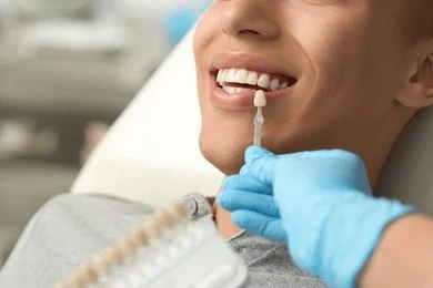 dental veneers near you