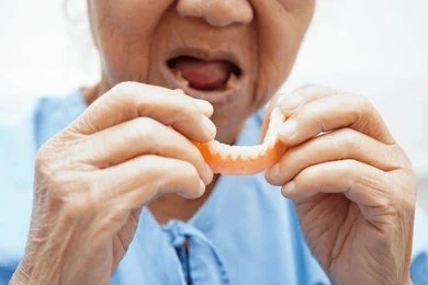 full dentures in fort myers fl