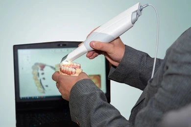 intraoral scanners in fort myers fl